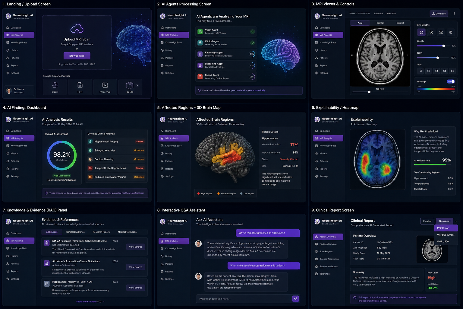 NeuroInsight AI dashboard