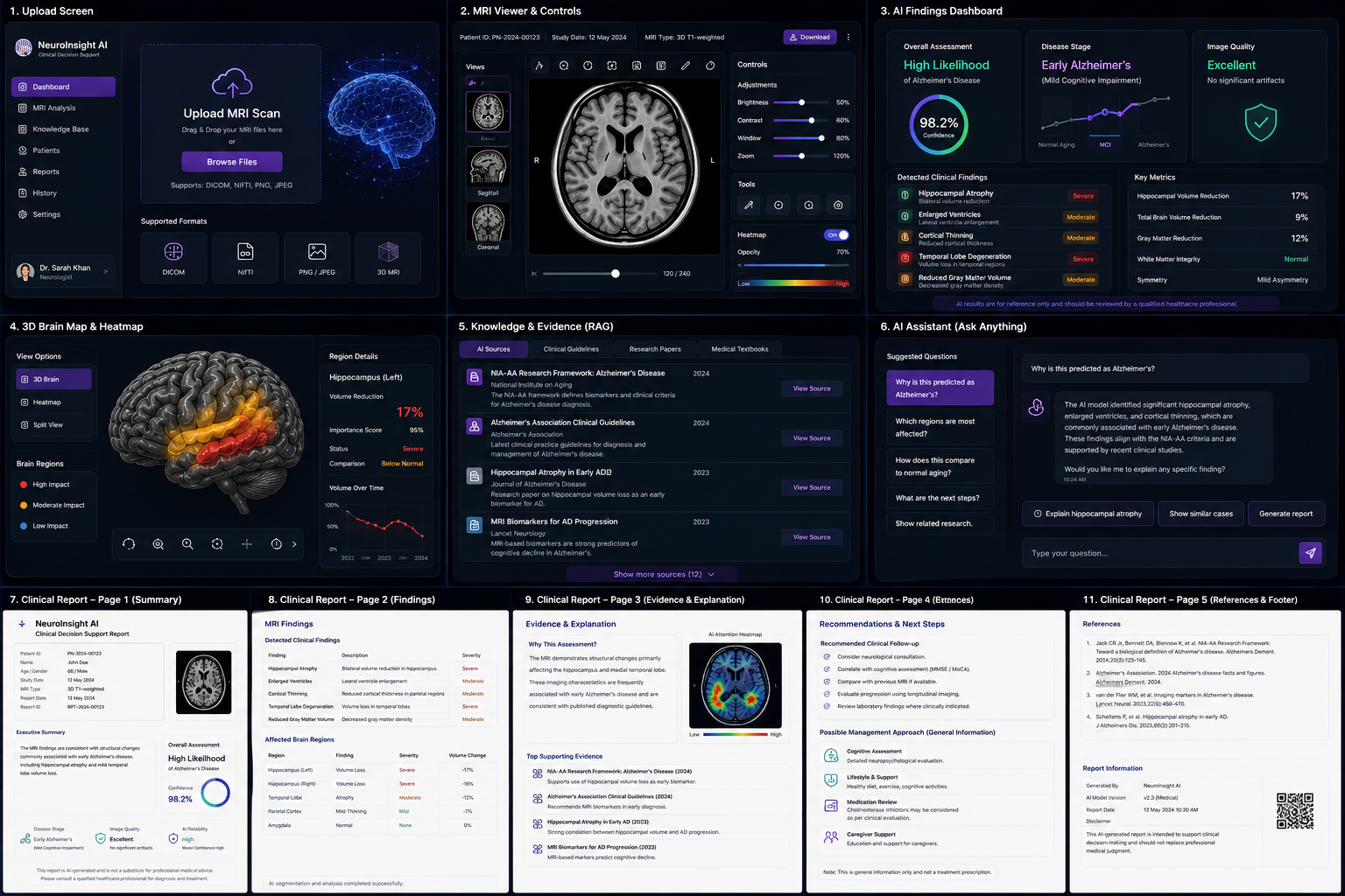 NeuroInsight AI multi-planar MRI viewer