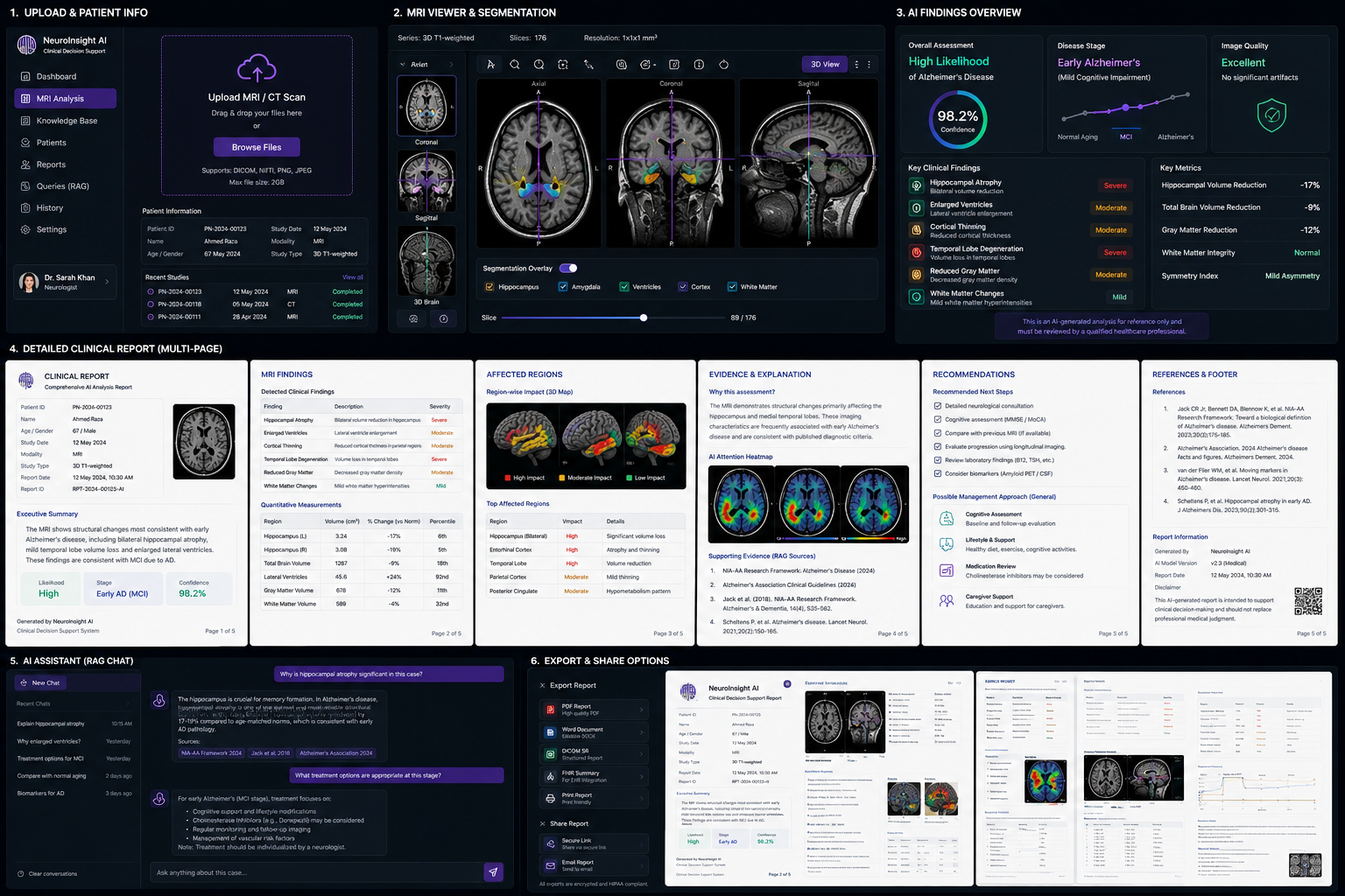 NeuroInsight AI 3D brain visualization
