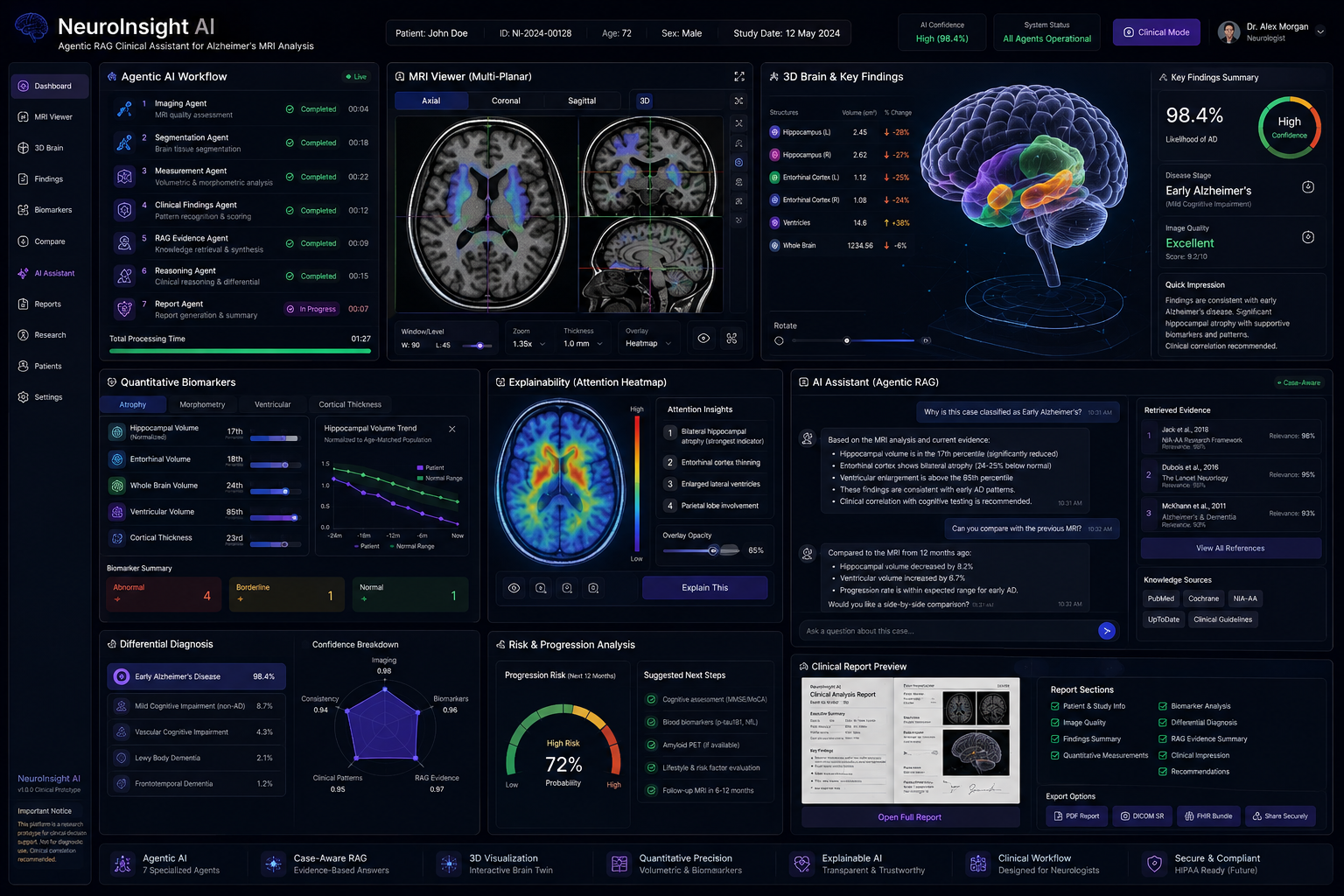 NeuroInsight AI structured clinical report